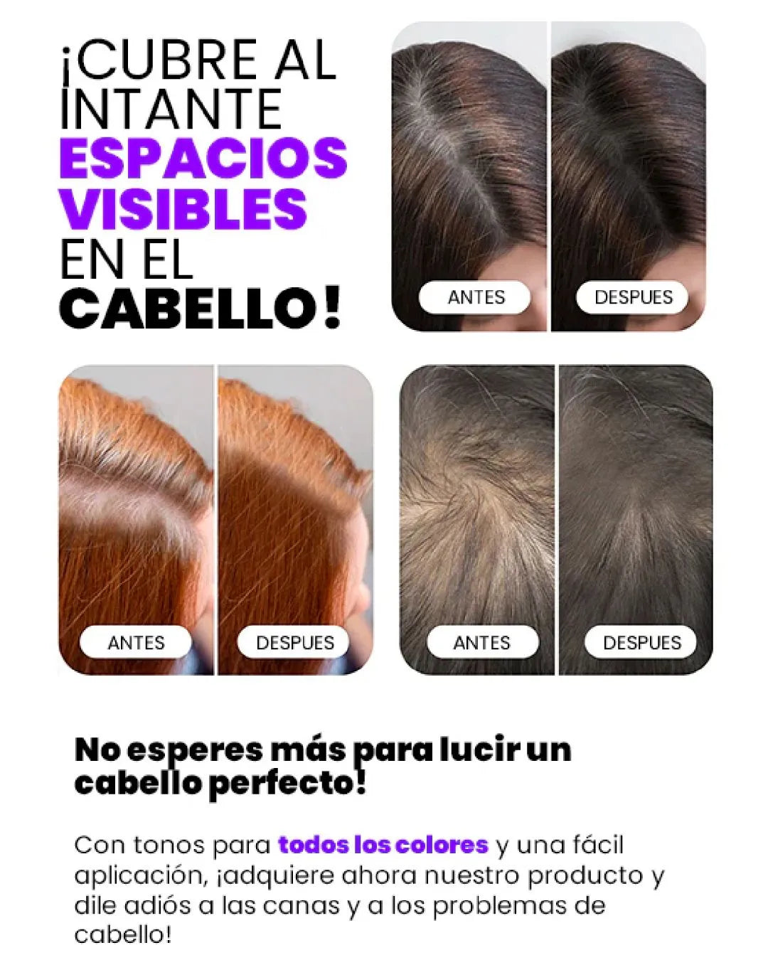 ¡Dile adiós a las canas y siéntete joven otra vez! ✨Bunee Hairline